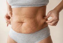 Excesso de pele após emagrecimento: por que acontece e quando a cirurgia deixa de ser estética para virar necessidade
